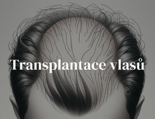 Transplantace vlasů